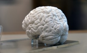 Türkiye'de bir ilk: Prof. Dr. Nevzat Tarhan'ın beyni 3D ile kopyalandı